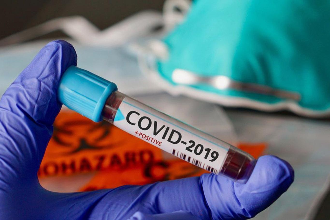 Fransa'da Coronavirus salgınında ikinci dalga: 24 saatte 2 bin 669 yeni vaka